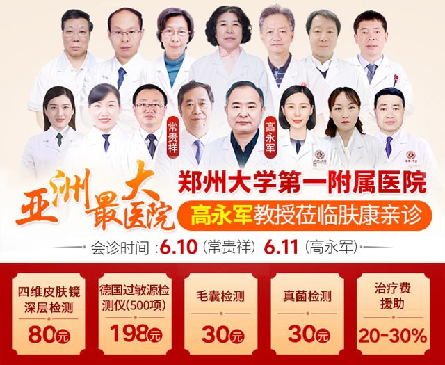 肤康通知:6月10至11特邀河南三甲皮肤名医联合会诊