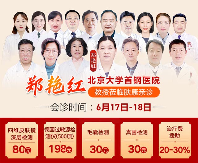 肤康通知:6月17至18北京三甲皮肤名医郑艳红教授亲诊