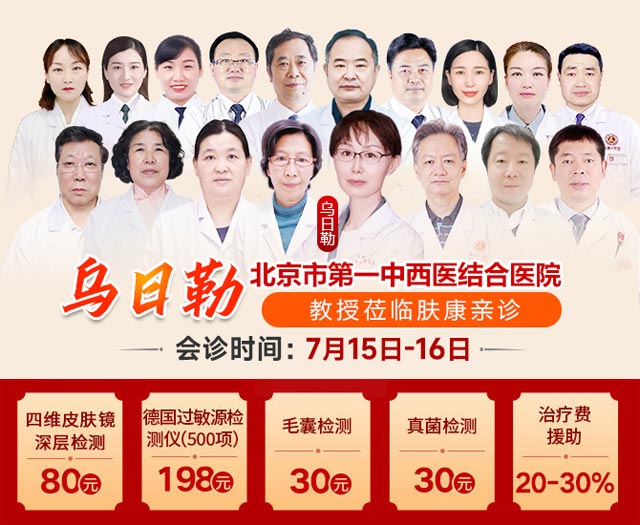 [7.15-16]郑州肤康皮肤病医院特邀北京乌日勒教授联合会诊